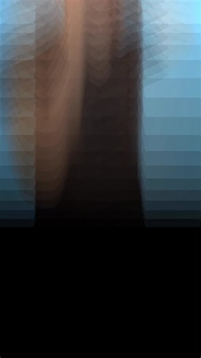 48K views · 487 reactions | Neck cracking might feel satisfying but it can lead to potentially life threatening issues like a stroke. Use caution or avoid it altogether. #medical #neck #science #doctor #fyp #chiro | Dr.Z Neurosurgery | Facebook