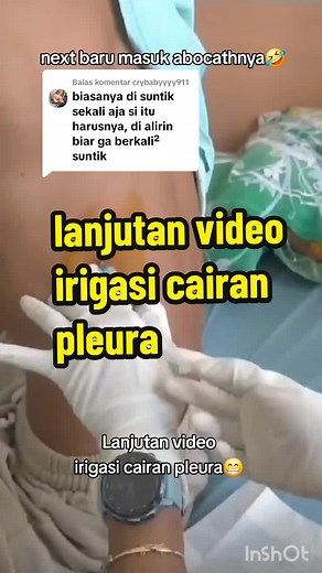 Membalas @crybabyyyy911 sengaja d pisah. videonya biar step yg biasanya d liat ditaruh d akhir saja..😁😁😁 #ctscan #radiologi #radiology #ge #scan #xray #mri #scanning #fyp #fypシ #fypシ゚viral #fypage #rontgen #ronsen #radiologist #radiologylife #radiologytechnologist #radiologytiktok #radiolog #MRI #RADIOLOGI #RONTGEN #CTSCAN #RADIASI #XRAY #TULANG #TUMOR #KANKER #PEMERIKSAAN #RADIOLOGIPEDIA #penyakit