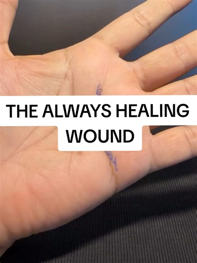 The Always Healing Wound: Palmistry and Spirituality
