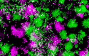 A Bacterial small RNA That Regulates Infection – Lifeboat News: The Blog