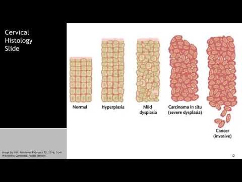 Incidence and Etiology of Cancer - Introduction to the Biology of Cancer #3