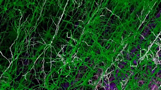 @clinsearchinc on Instagram: "I’ve been closely following the @alleninstitute and its groundbreaking work in digital imaging and computational neuroscience, and a new development reported by Reuters immediately caught my attention. Scientists have used one of the world’s fastest supercomputers to create an exceptionally detailed virtual model of the mouse cortex, a “digital brain” with nearly 10 million neurons and roughly 26 billion synapses. The level of detail offers a powerful new way to stu