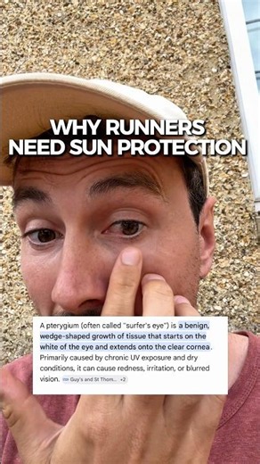 Why you need to protect your eyes from UV