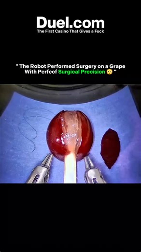 EROUN 007 on Instagram: "Watch how robotic surgery achieves exact control. The da Vinci system peels a grape to show its fine precision. Its 3D vision and magnification let surgeons see details smaller than a millimeter. The system translates hand movements into smooth robotic actions, reducing tremors. This technology helps perform complex surgeries with minimal cuts and faster recovery for patients. via : daVinciSurgery/YT #knowledge #history #innovation #technology #fyp #tech #didyouknow #big