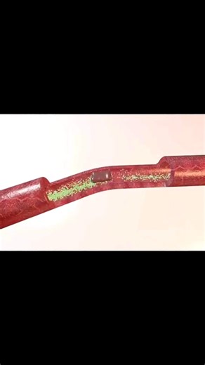 106K views · 1.7K reactions | How to Reverse ED Without Pills: 5 Simple Lifestyle Hacks! Credit@ Dr. Eric Berg.. | Fasting Edge | Facebook