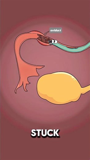 What Happened When…… Fallopian Tube Got Blocked 😱..!!#2danimation #health #fyp #pregnancy