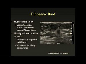 049 The New BI RADS for Mammography and Ultrasound Medstudylab.com