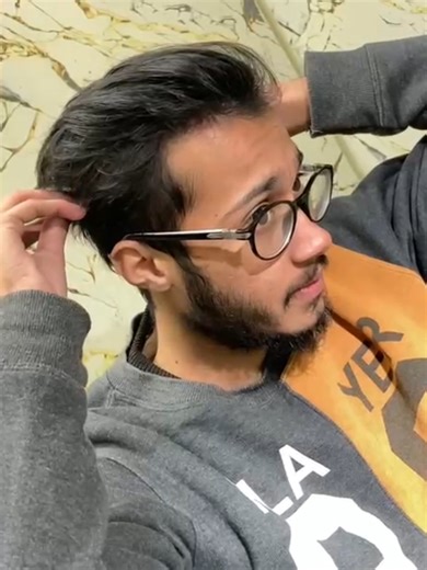 Best Front Line hair patch | Best Receding hair line solution.#wig #recedinghairline #views #nonsurgical #lahore