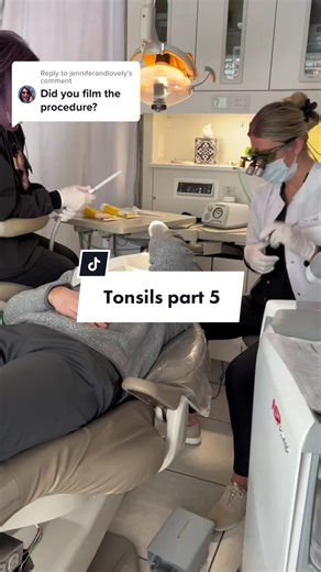 LASERING Tonsils Procedure Explained