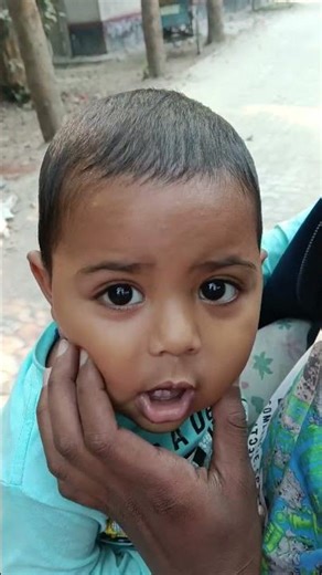 Baby 🍼 Reaction After Cheek Pinch 😆🔥 #shorts