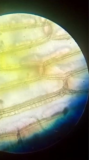 observation microscopique de la cellule d'oignon