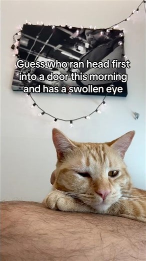 She has a swollen eye because of this 🥲