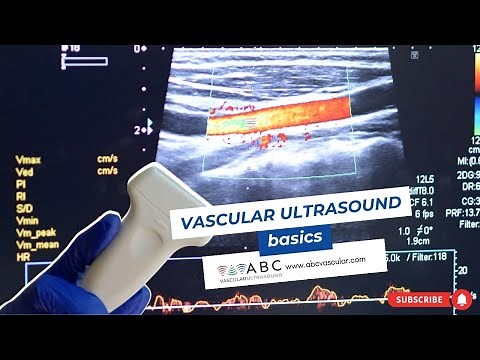 Vascular ultrasound basics