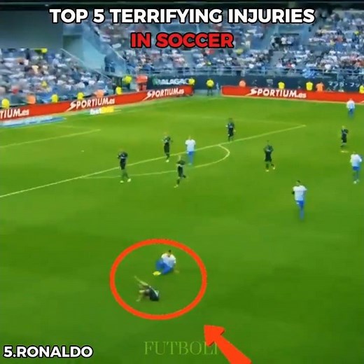 Worst Football Injuries Ever Caught on Camera #soccer #football #brutal