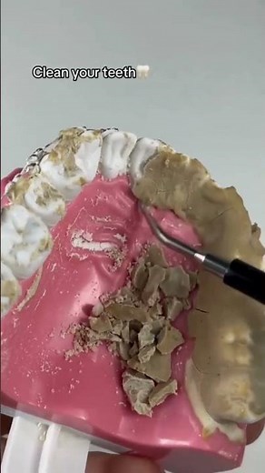 How To Remove Plaque And Tartar From Teeth At Home Naturally?🦷How To Clean Teeth #shorts