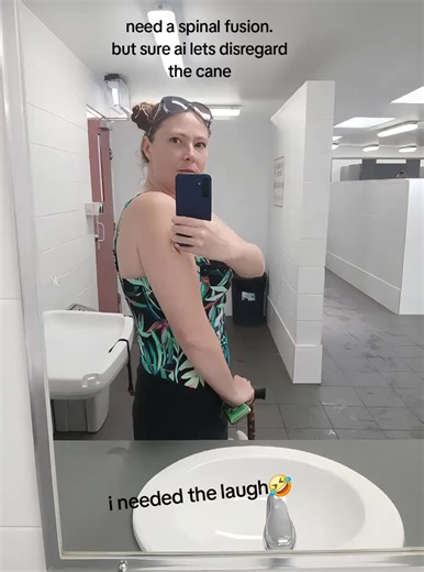 Understanding Spinal Fusion Surgery and Recovery