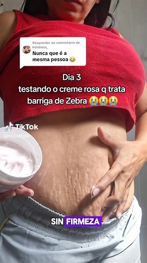 La crema ADEUS ayuda a mejorar la apariencia de las estrías y a devolverle suavidad y elasticidad a tu piel. 🌿 Con colágeno, vitaminas y extractos naturales. ✨ Ideal para abdomen, glúteos y piernas. 👙 ¡Recupera tu confianza frente al espejo! | Crema rosa Adeus Perú