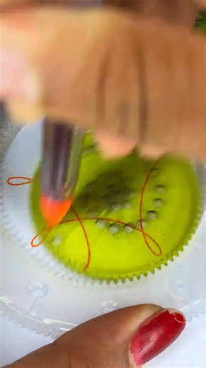 1.4K views | #SpirographSHR #SHRTechnology #NextGenHairRemoval...