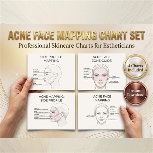 Acne Face Mapping Guide | Digital Download & Skin Analysis Chart for Estheticians - Etsy