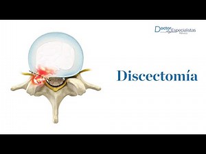 Discectomia - Doctores Especialistas