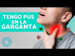 Why Do You Get PUS in Your THROAT? ⚪ (Throat Infection with Pus)