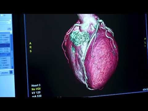 Cardiac Screening Test | Your heart health matters | Apollo One