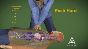 CPR - 3D Medical Animation Cardiopulmonary Resuscitation Like ✔ Comment ✔ Tag ✔ Share ✔ Health, Safety & Environment - Freelance Services | Health, Safety & Environment - HSE Education