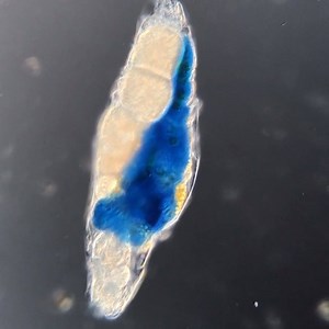 102K views · 1.7K reactions | This rotifer is what it eats! It has turned blue due to the breakdown of pigments from algae and cyanobacteria — both components of its diet. It has a ciliated mouth and is about 500 microns (half a millimeter) in length. Three eggs can clearly be seen within the body of this wiggly creature. #MicroscopicMonday 匿by MicrobialEcology | Science Channel | Facebook