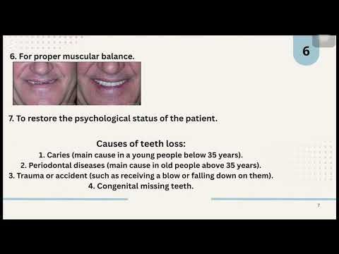 LEC1:Removable Partial Dentures