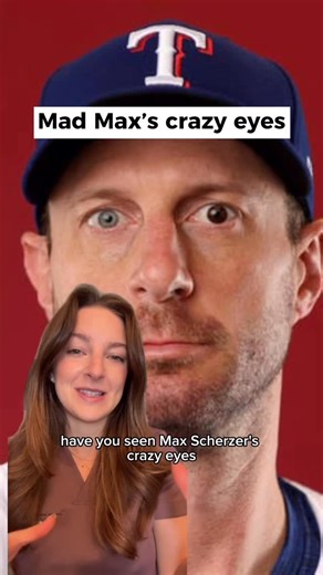 Dr. Alexa Hecht | Optometrist on Instagram: "Ever wonder why Max Scherzer has two different colored eyes? #eyedoctor #bluejays #maxscherzer #heterochromia"