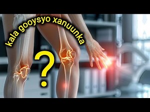 Xanuunka lafaha , kala goosyada sida jilbaha wax kaste oo sababo , Baaritaanada iyo Daawooyinka.....
