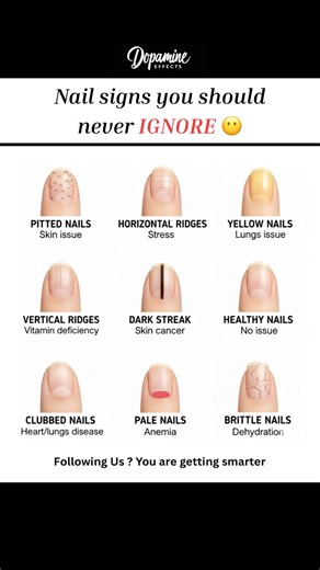 Nail signs you should never IGNORE 😳