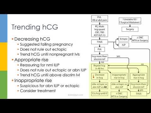 Learn OB/GYN: Ectopic Pregnancy
