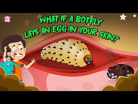 Deadliest Botfly Infestation | Are Bot Flies Harmful to Humans? | Human Botfly Facts | Dr. Binocs