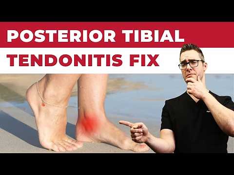 Inside of the Ankle Pain [Posterior Tibial Tendonitis Treatment]