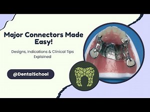 Major Connectors in RPD: Designs, Indications, and Clinical Guidelines
