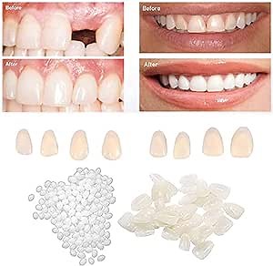 BEGUT Fake Teeth, Tooth Repair Kit , Temporary Tooth Repair kit for Filling The Missing Broken Tooth & Gaps-Moldable Fake Teeth & Thermal Beads Replacement Kit, No. of items 100, 16.0 Ounce