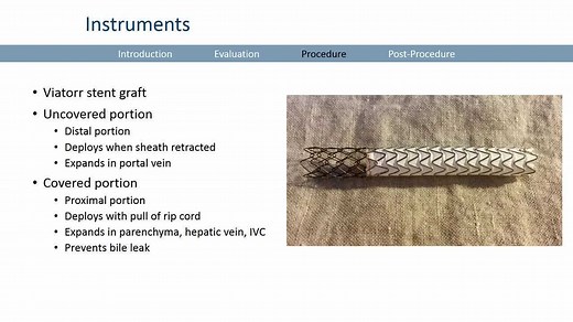 TIPS手术过程详解-1