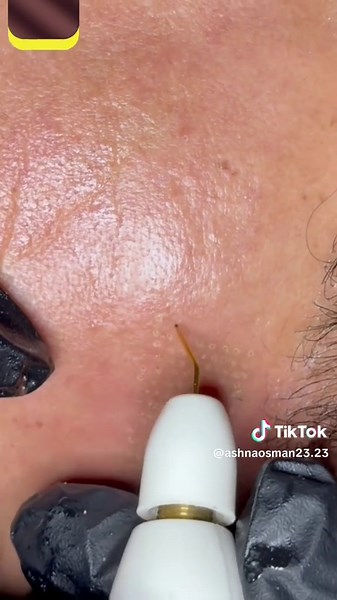 plasma pen glow a hand for beauty , a hand for art Be patient.. there is more magic in the way 🇹🇯 کوردی “پلازماپێن گڵۆ ✨ دەستێک بۆ جوانی، دەستێک بۆ هونەر. چاوه ری که ن چەند جادوی تر لە ڕێگادایە 🔥” 🇩🇪 Deutsch “Plasma Glow Eine Hand für die Schönheit, eine Hand für die Kunst. Habt Geduld… noch mehr Magie ist unterwegs.” 🇮🇷 فارسی “پلازما پن گلو ✨ دستی برای زیبایی، دستی برای هنر. صبر کنید… جادوی بیشتری در راه است. ## plasmapen #world #fyp #kurdistan #Pla#PlasmaPenانکاری