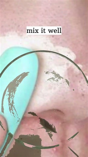 Remove whiteheads at home| Step 1 #witeheads#skinproblem #homeremdies