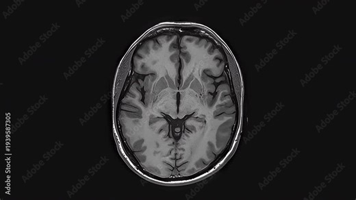 Inner Universe: Animated MRI Brain Visualization. MRI scanning with spatial layer analysis in brain research demonstrates the technology's high effectiveness in detecting abnormalities