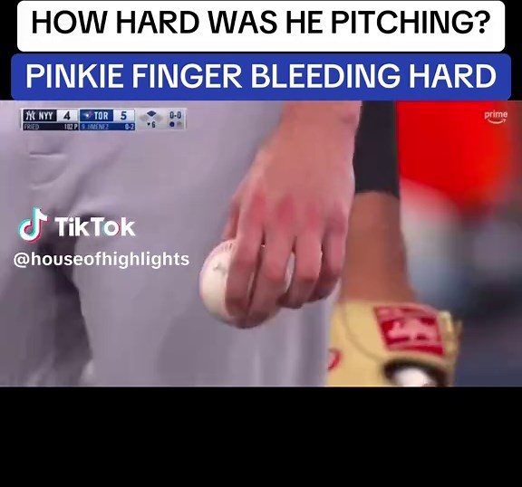 Max Fried's Intense Pitching Against Yankees