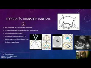 Ecografia Transfontanelar