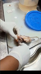 Myometrium tissue from the uterus|#hi #histopathology #cervicaltreatment #histomuseum #cancer #histo