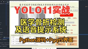 基于YOLO11深度学习的医学X光骨折检测与语音提示系统【python源码 Pyqt5界面 数据集 训练代码】