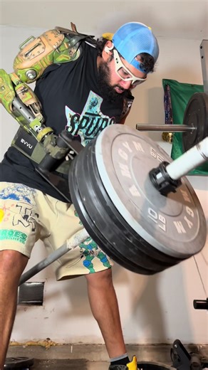 Misconceptions About Prosthetic Arms Explained