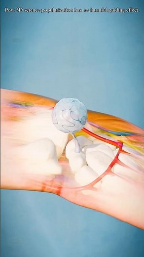 Ganglion Cyst Removal Surgery (3D Animation) #youtubeshorts #foryou #3dmedicalanimation #usa