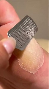 Satisfying CALLUS REMOVAL Transformation - 4K Close Up!