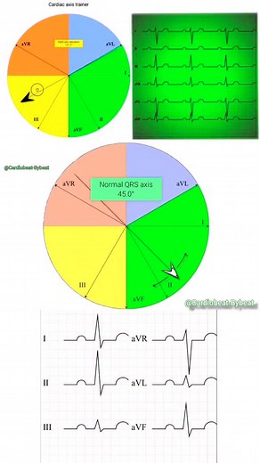 Cardiac axis Trainer 👉Journal of Brown Hospital Medicine© #ECG #Cardiology #Electrophysiology #MedEd #CardiacAxis #MedicalEducation #ClinicalSkills #Heart | Abdallah Othman