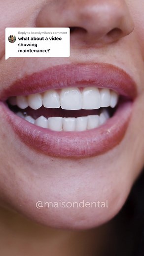 Composite Conditioning for Dental Bonding Makeovers